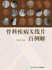 骨科疾病X线片百例解