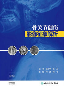 骨关节创伤影像征象解析