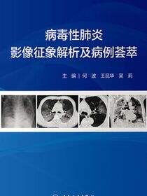 病毒性肺炎影像征象解析及病例荟萃