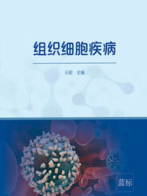 组织细胞疾病