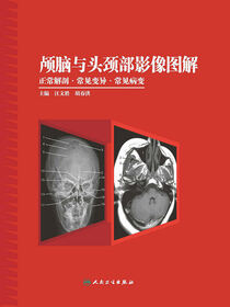 颅脑与头颈部影像图解：正常解剖·常见变异·常见病变