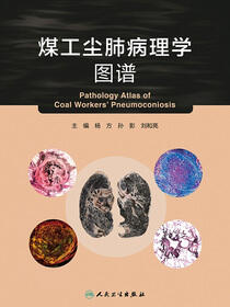 煤工尘肺病理学图谱