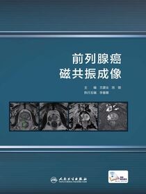 前列腺癌磁共振成像