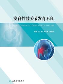 发育性髋关节发育不良