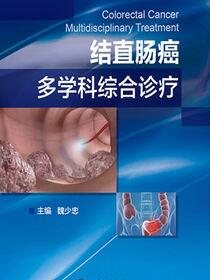 结直肠癌多学科综合诊疗