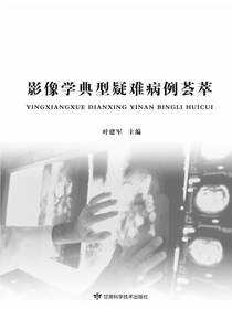 影像学典型疑难病例荟萃
