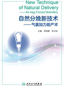自然分娩新技术——气囊加力助产术