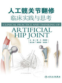 人工髋关节翻修临床实践与思考