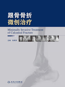 跟骨骨折微创治疗