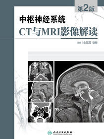 中枢神经系统CT和MRI影像解读（第2版）