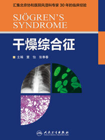 干燥综合征