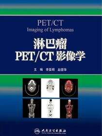 淋巴瘤PET/CT影像学