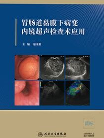 胃肠道黏膜下病变内镜超声检查术应用