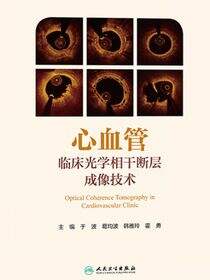 心血管临床光学相干断层成像技术