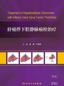 肝癌伴下腔静脉癌栓治疗