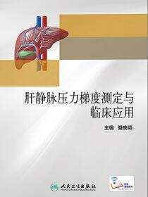 肝静脉压力梯度测定与临床应用