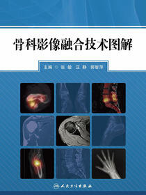 骨科影像融合技术图解