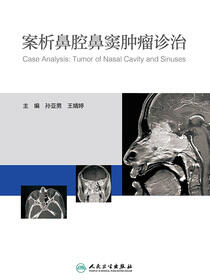 案析鼻腔鼻窦肿瘤诊治