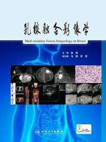 乳腺融合影像学
