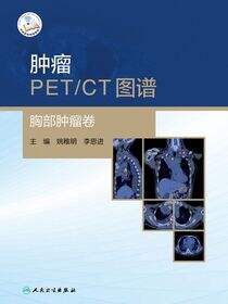 肿瘤PET／CT图谱——胸部肿瘤卷